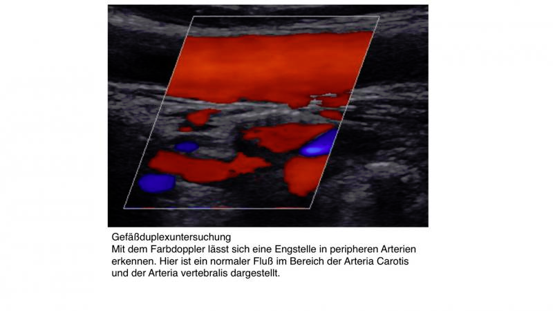 Darstellung Ultraschall